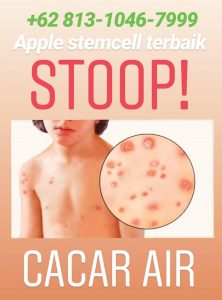 +62 813-1046-7999 Distributor Ramuan Herbal Untuk Cacar Air paling Ampuh, Apple Stem Cell Asli